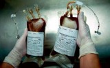 Фото medpulse.ru